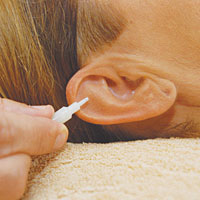 Tinnitus